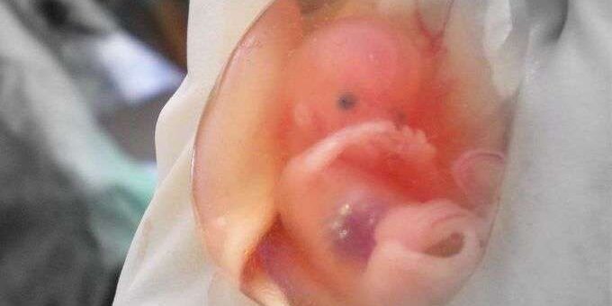 AbortoEstadosUnidos_WikimediaCommons_030119